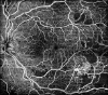 Angiographie